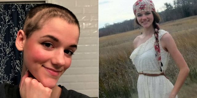 Hair Pulling Disorder In Children
 New York woman with hair pulling disorder shaves head in