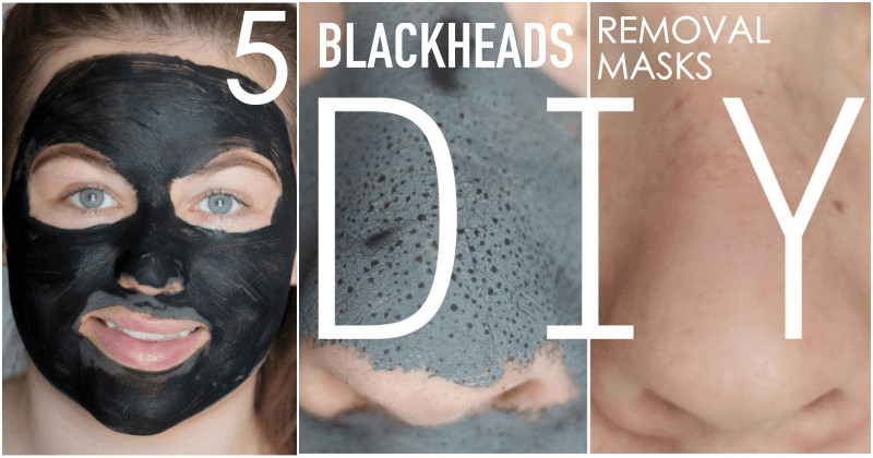 Best Face Mask For Blackhead Removal DIY
 Get Rid Blackheads In 5 Minutes Applying This Mask