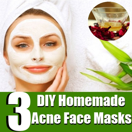 DIY Acne Face Mask
 Top 3 DIY Homemade Acne Face Masks