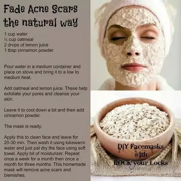 DIY Acne Face Mask
 What are the best DIY face masks for acne scars Quora