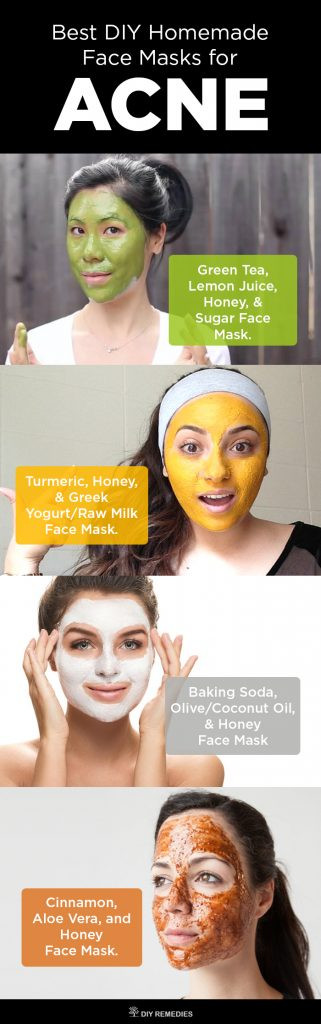 DIY Acne Face Mask
 6 Best DIY Homemade Face Masks for Acne