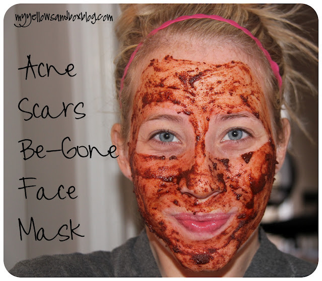 DIY Acne Scar Mask
 Diva Tube [DIY] Homemade Acne Scars Be gone Face Mask