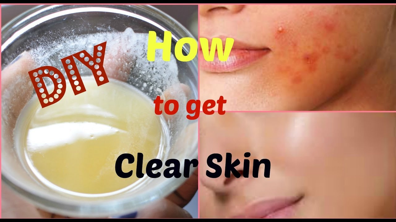 DIY Acne Scar Mask
 DIY Face Mask to Get Rid of Acne & Acne Scars FAST