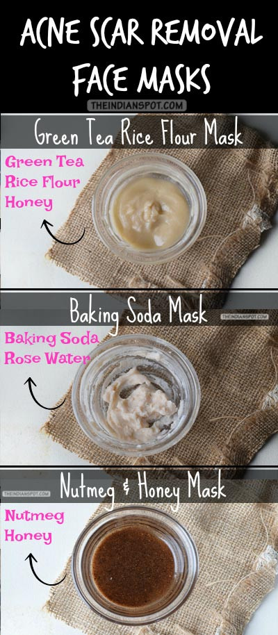 DIY Acne Scar Mask
 Fade acne scar with 5 homemade masks THEINDIANSPOT