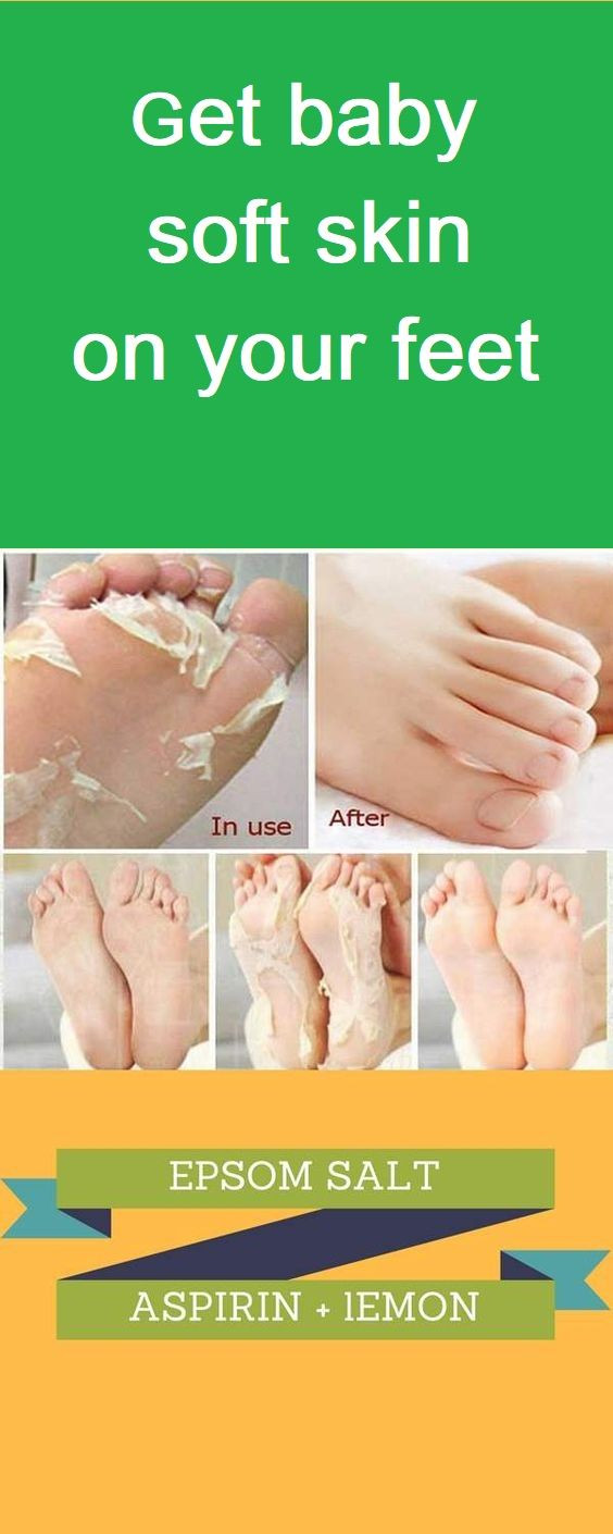 Diy Baby Foot Peel
 Here is a basic homemade recipe for removing dead and dry
