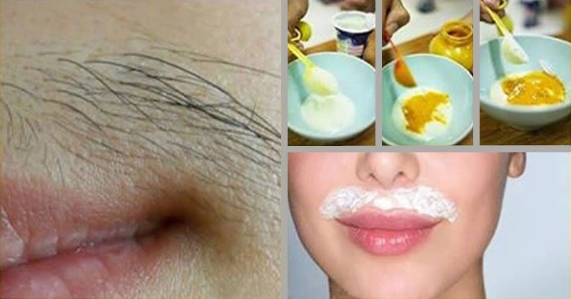 DIY Upper Lip Hair Removal
 Amazing Methods To Remove Hair From Your Upper Lips