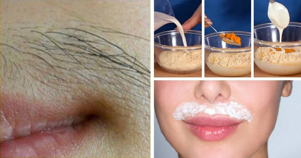 DIY Upper Lip Hair Removal
 How To Remove Upper Lip Hair Permanently At Home Quickly