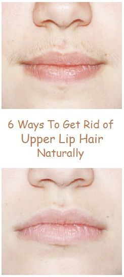 DIY Upper Lip Hair Removal
 6 Ways To Get Rid of Upper Lip Hair Naturally