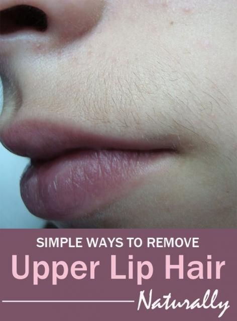 DIY Upper Lip Hair Removal
 SIMPLE WAYS TO REMOVE UPPER LIP HAIR NATURALLY