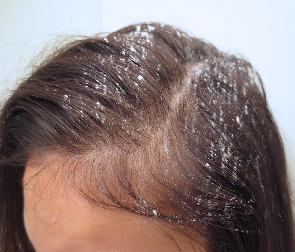 Does Baby Powder Help Greasy Hair
 Mom Approved Beauty Hacks You ll Love