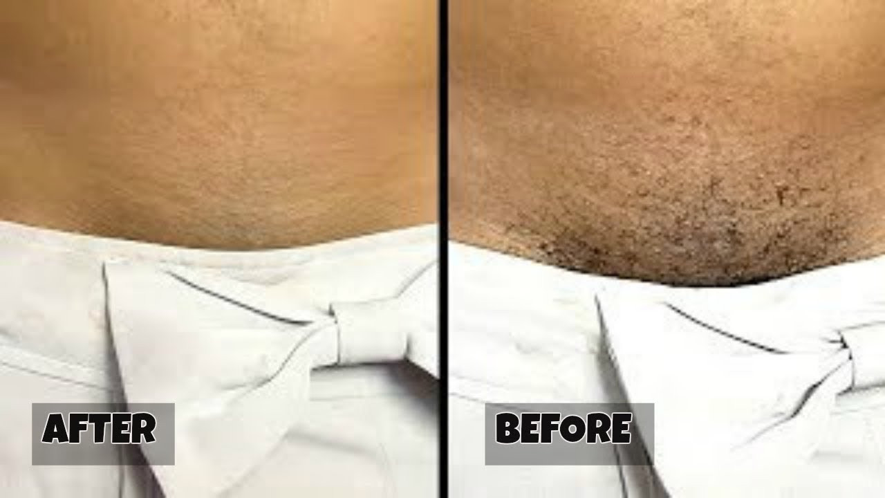How To Cut Pubic Hair Male
 STOP SHAVING THIS IS HOW YOU SHOULD REMOVE PUBIC HAIR