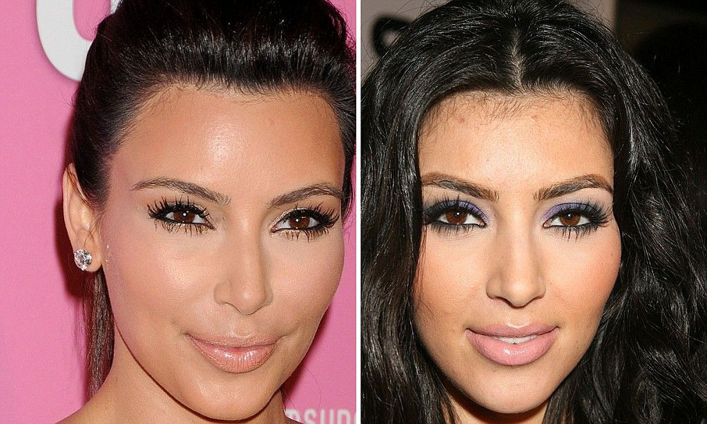 Laser Hair Removal Baby Hair
 How facial hair removal keeps Kim Kardashian young