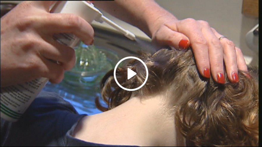 Lice In Kids' Hair Pictures
 Nits outbreak has parents scratching heads for effective