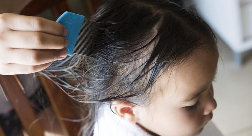 Lice In Kids' Hair Pictures
 Head lice 101 What lice look like how they behave and