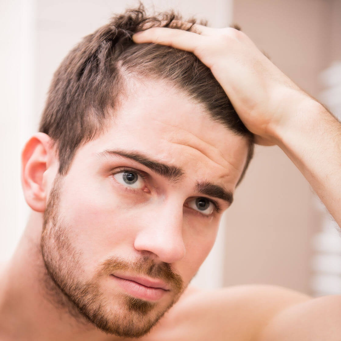 Male Pattern Baldness Hairstyles
 People With No Hair