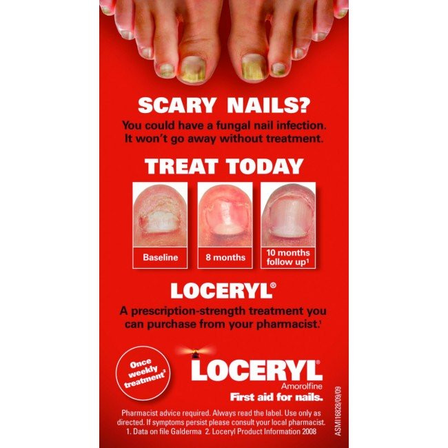 Pretty Nails Limerick Pa
 Loceryl Fungal Nail Treatment Reviews Nail Ftempo