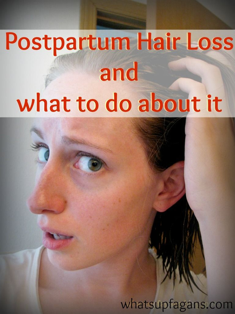 Thinning Hair After Baby
 Pin on Pregnancy and Parenting on Pinterest